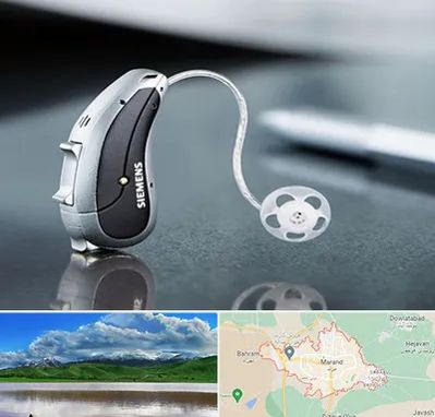 نمایندگی سمعک زیمنس در مرند