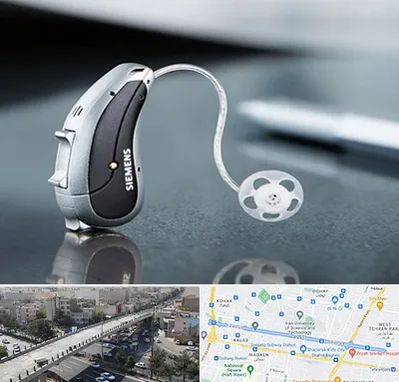 نمایندگی سمعک زیمنس در فرجام 