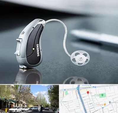 نمایندگی سمعک زیمنس در کوی فیروز تبریز