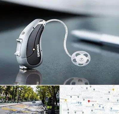 نمایندگی سمعک زیمنس در میرداماد 