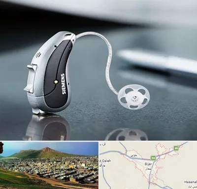نمایندگی سمعک زیمنس در بیجار