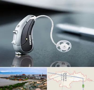 نمایندگی سمعک زیمنس در بندر ترکمن