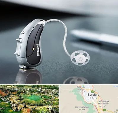 نمایندگی سمعک زیمنس در بروجرد