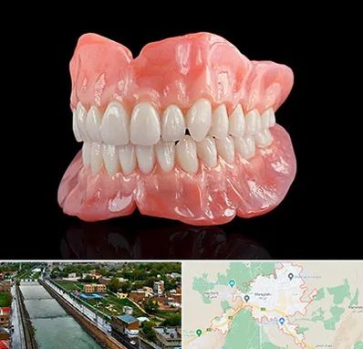 ساخت دندان مصنوعی در مراغه