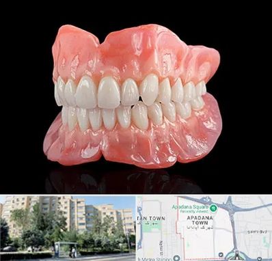 ساخت دندان مصنوعی در آپادانا