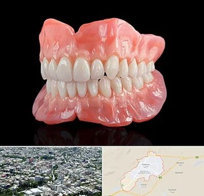 ساخت دندان مصنوعی در شاهرود