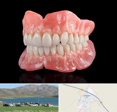 ساخت دندان مصنوعی در دهگلان