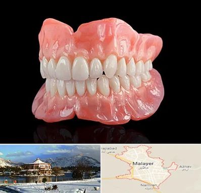 ساخت دندان مصنوعی در ملایر