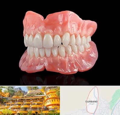 ساخت دندان مصنوعی در دربند