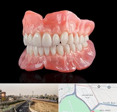 ساخت دندان مصنوعی در جوادیه