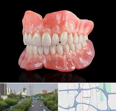 ساخت دندان مصنوعی در توانیر