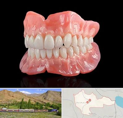 ساخت دندان مصنوعی در خاش