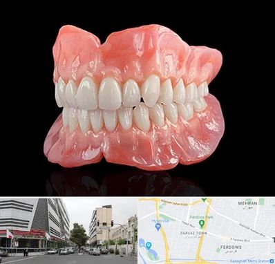 ساخت دندان مصنوعی در بلوار فردوس 