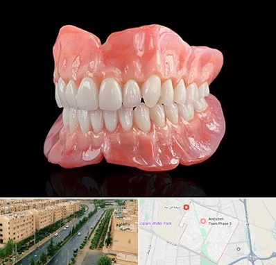 ساخت دندان مصنوعی در فاز سه اندیشه