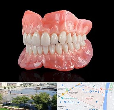 ساخت دندان مصنوعی در گلستان اهواز 
