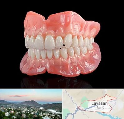 ساخت دندان مصنوعی در لواسان