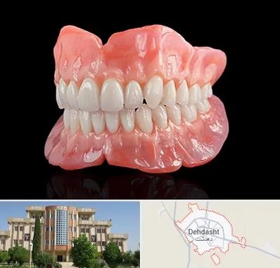 ساخت دندان مصنوعی در دهدشت