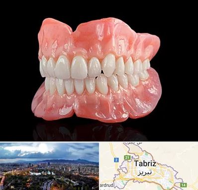ساخت دندان مصنوعی در تبریز