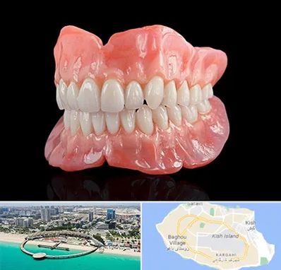 ساخت دندان مصنوعی در کیش