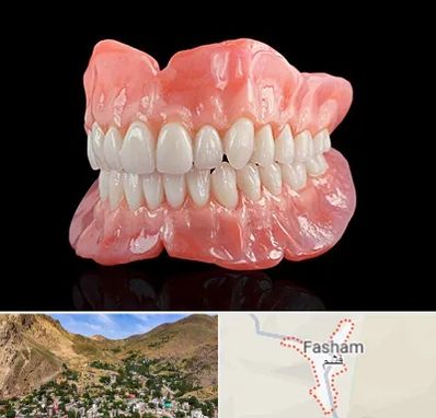 ساخت دندان مصنوعی در فشم