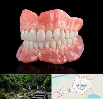ساخت دندان مصنوعی در علی آباد کتول