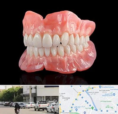 ساخت دندان مصنوعی در قدوسی شرقی شیراز