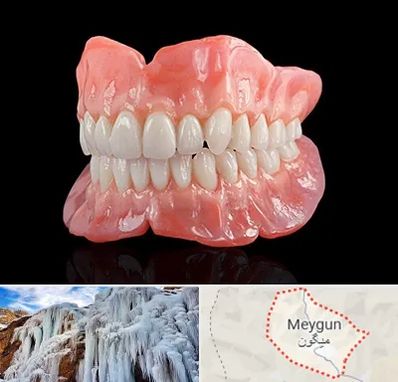 ساخت دندان مصنوعی در میگون
