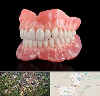 ساخت دندان مصنوعی در دماوند