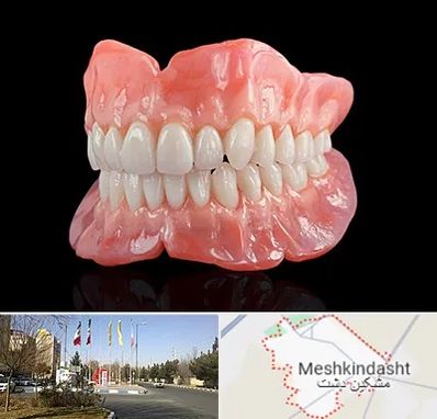 ساخت دندان مصنوعی در مشکین دشت