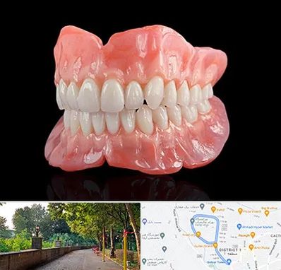 ساخت دندان مصنوعی در فلکه گاز رشت 