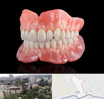ساخت دندان مصنوعی در اوین