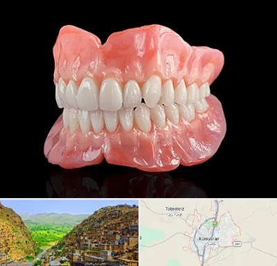 ساخت دندان مصنوعی در کامیاران