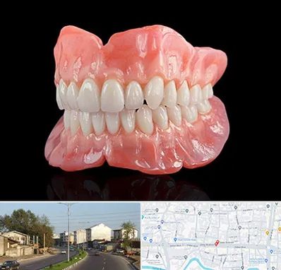 ساخت دندان مصنوعی در ضیابری رشت 