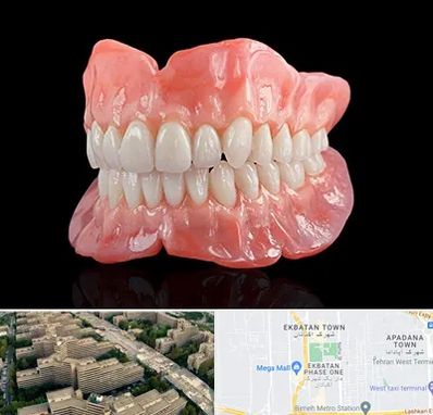 ساخت دندان مصنوعی در اکباتان 