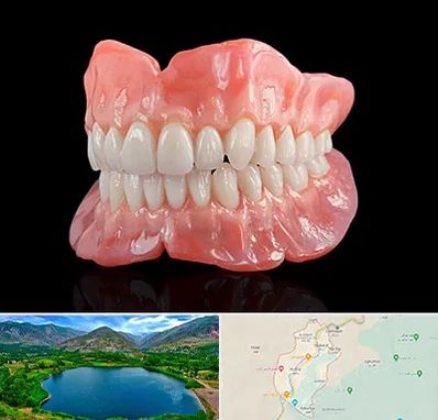 ساخت دندان مصنوعی در رودبار