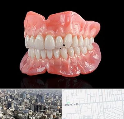 ساخت دندان مصنوعی در جیحون