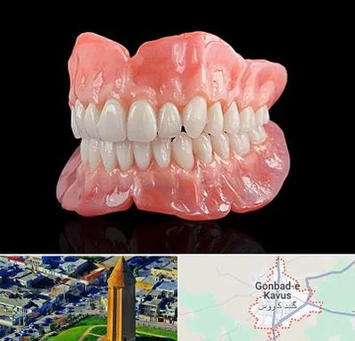 ساخت دندان مصنوعی در گنبد کاووس