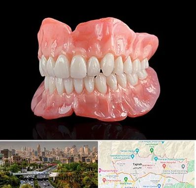 ساخت دندان مصنوعی در منطقه 1 تهران 