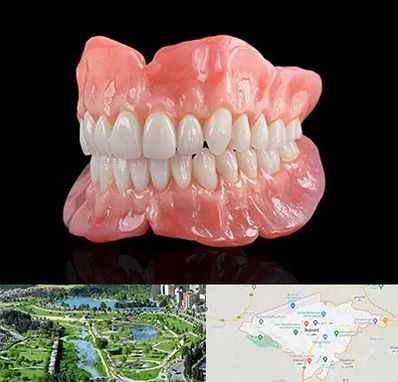 ساخت دندان مصنوعی در بجنورد