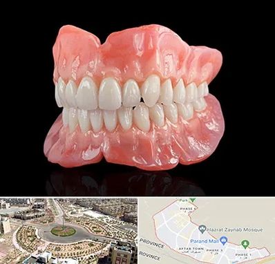 ساخت دندان مصنوعی در پرند