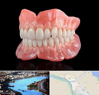 ساخت دندان مصنوعی در خرمشهر