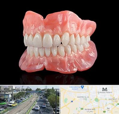 ساخت دندان مصنوعی در جنوب تهران 