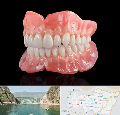 ساخت دندان مصنوعی در ایلام