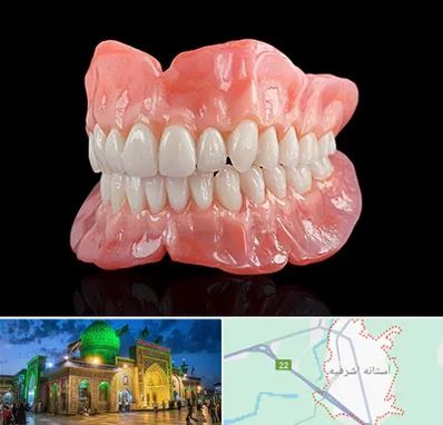 ساخت دندان مصنوعی در آستانه اشرفیه