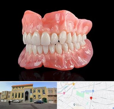 ساخت دندان مصنوعی در زنبیل آباد قم