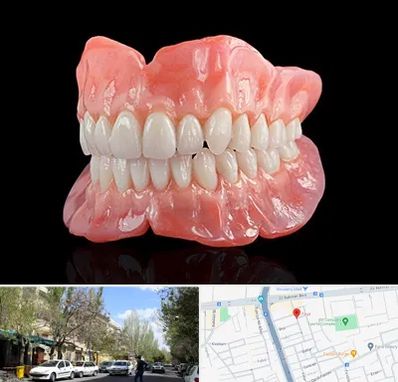 ساخت دندان مصنوعی در کوی فیروز تبریز