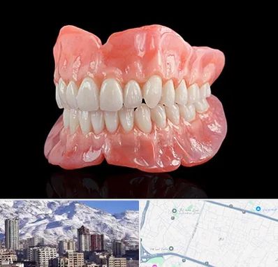 ساخت دندان مصنوعی در ازگل