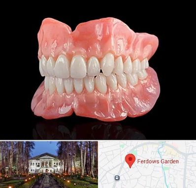 ساخت دندان مصنوعی در باغ فردوس