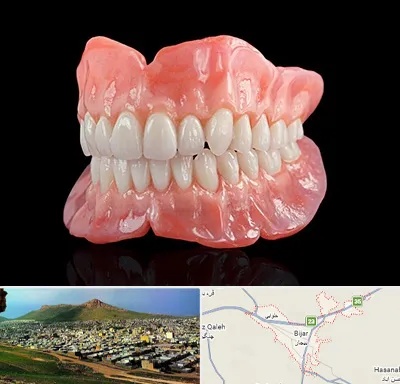 ساخت دندان مصنوعی در بیجار