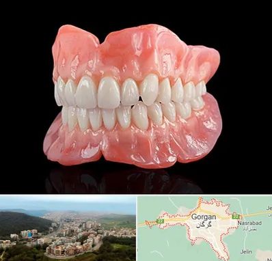 ساخت دندان مصنوعی در گرگان